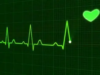 ekg